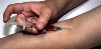 No se drogaba pero…